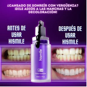 Hismile v34 - Crema Blanqueadora Dental